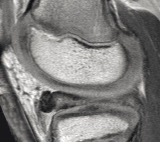 It is important that radiologists are ready to address this population and create quality images that the orthopedist can trust prior to open and arthroscopic surgical interventions.