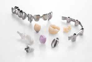 StRAUMAnn CARES Prosthetics BONE Level Customized Implant Prosthetics Straumann CARES CADCAM offers you a range of implant-borne prosthetic solutions in order to achieve high-quality dental implant