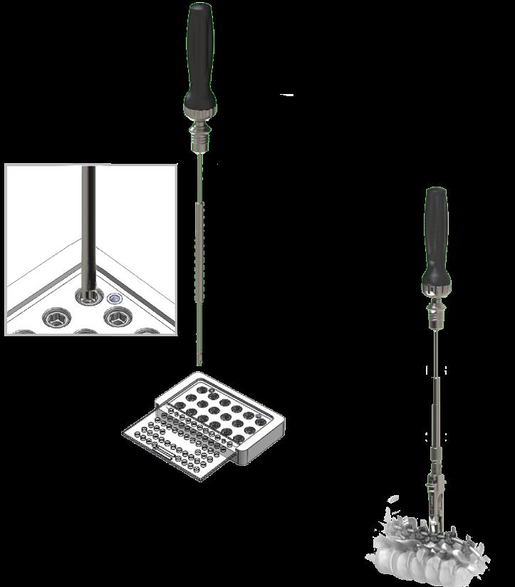 PEDICLE SCREW SURGICAL TECHNIQUE Provisionally Tighten Set Screws 3 Capture the appropriate set screw onto the hexalobe feature of the Large Set Screw Driver.