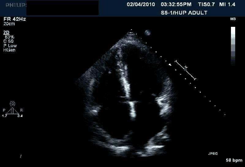 US/DS/MAR11/001 Representative Echocardiographs: