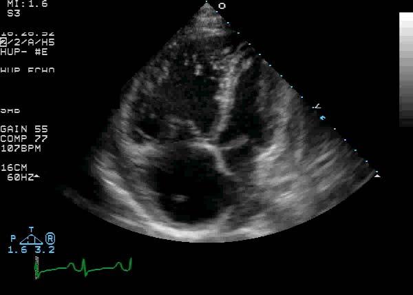 US/DS/MAR11/001 Echocardiographic Characterization of PAH