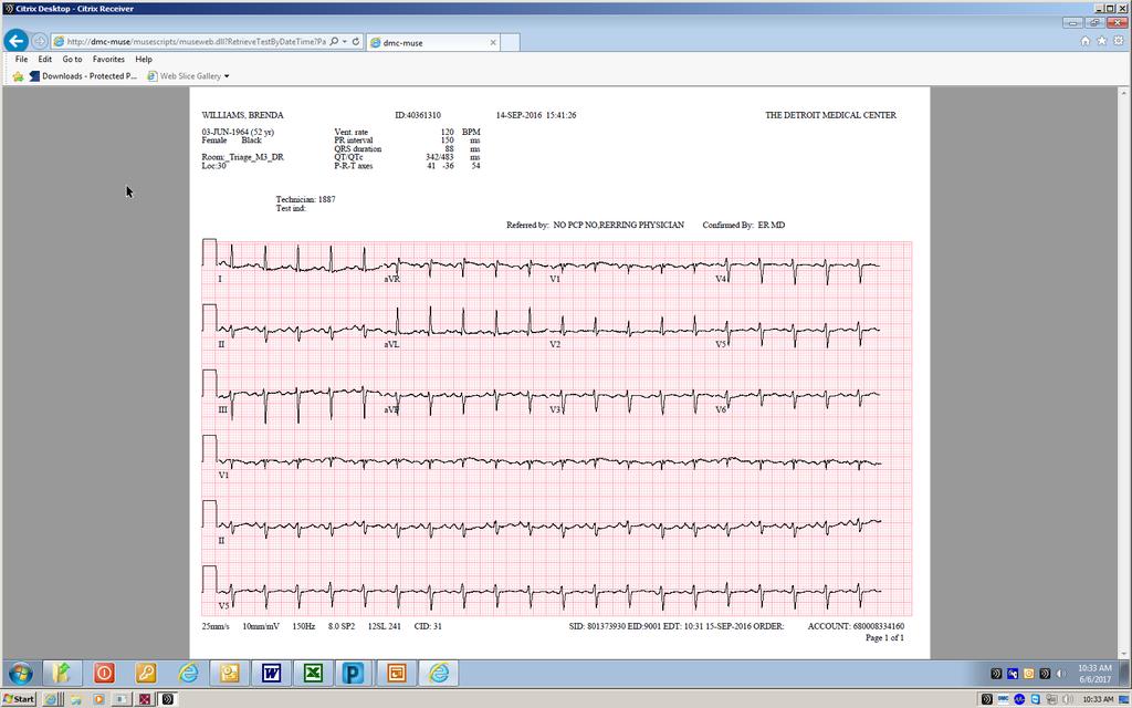 Electrocardiogram + Sinus tachycardia.