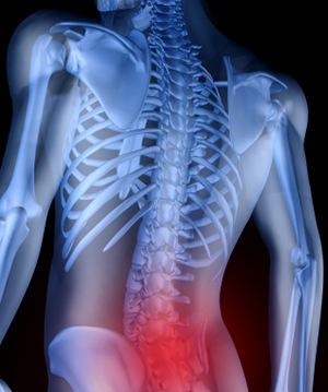 Chapter 2 Sciatica and Lower Back Pain Prevention The term sciatica describes a persistent pain felt along the sciatic nerve.