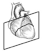 chamber Oblique - left ventricular