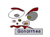 Gonorrhea Single dose