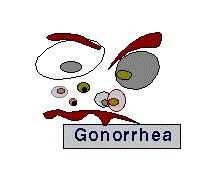 Gonorrhea Single dose treatment - usual Ceftriaxone 125 mg
