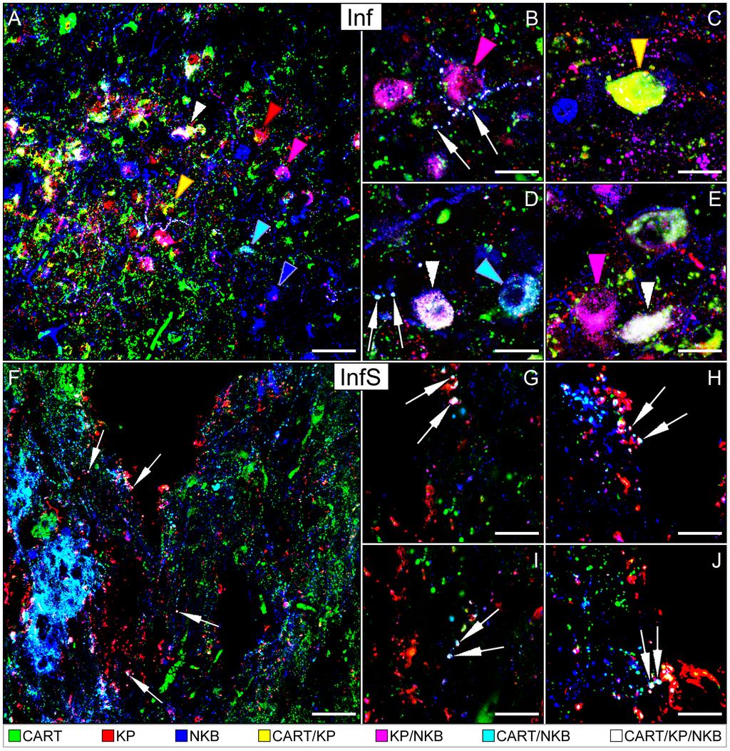 CART in Kisspeptin and Neurokinin B Neurons of the Human Figure 1.