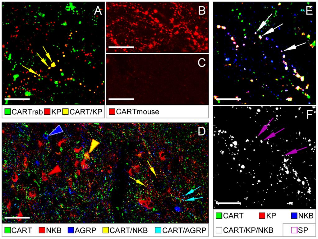CART in Kisspeptin and Neurokinin B Neurons of the Human Figure 3. Further characterization of CART-IR KP and NKB neurons.