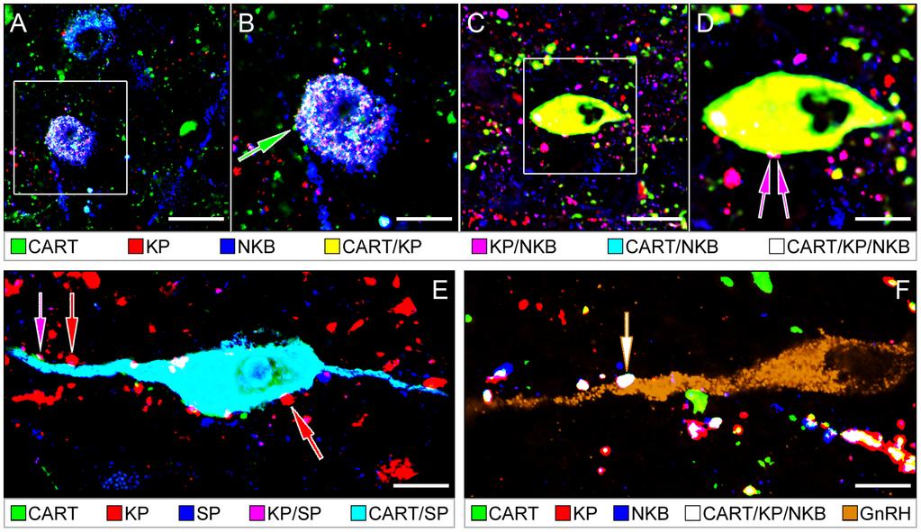 CART in Kisspeptin and Neurokinin B Neurons of the Human Figure 4.