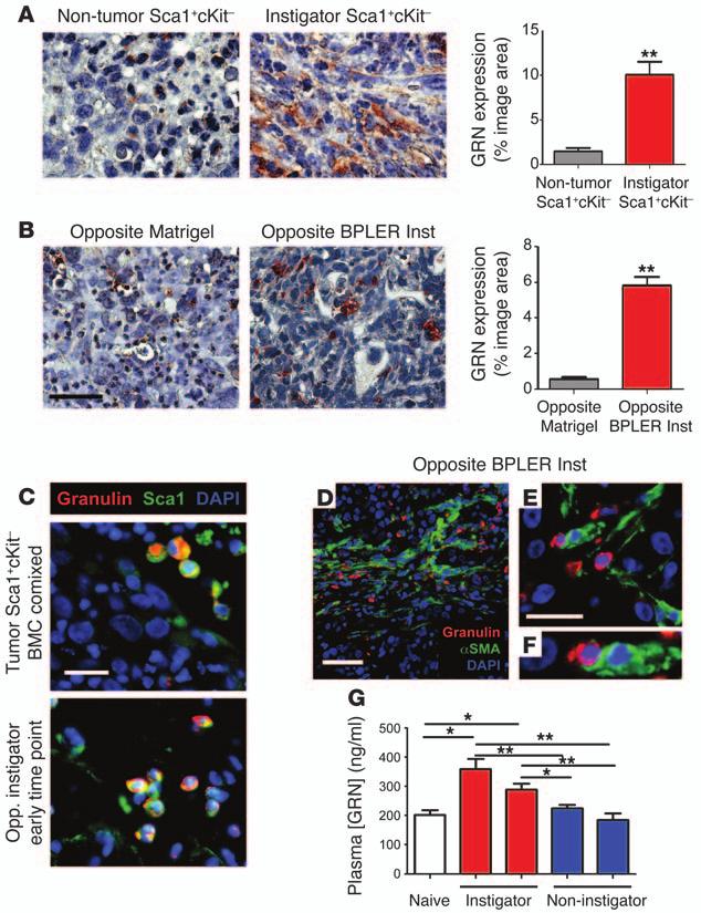 Figure 4 GRN + BMCs are selectively recruited to instigated tumors but do not give rise directly to tumor myofibroblasts.