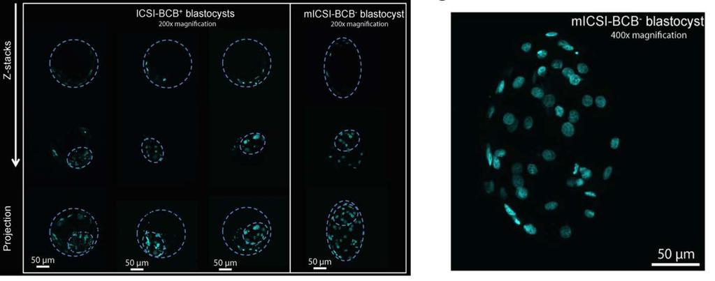 Improvement in development of BCB - embryos following