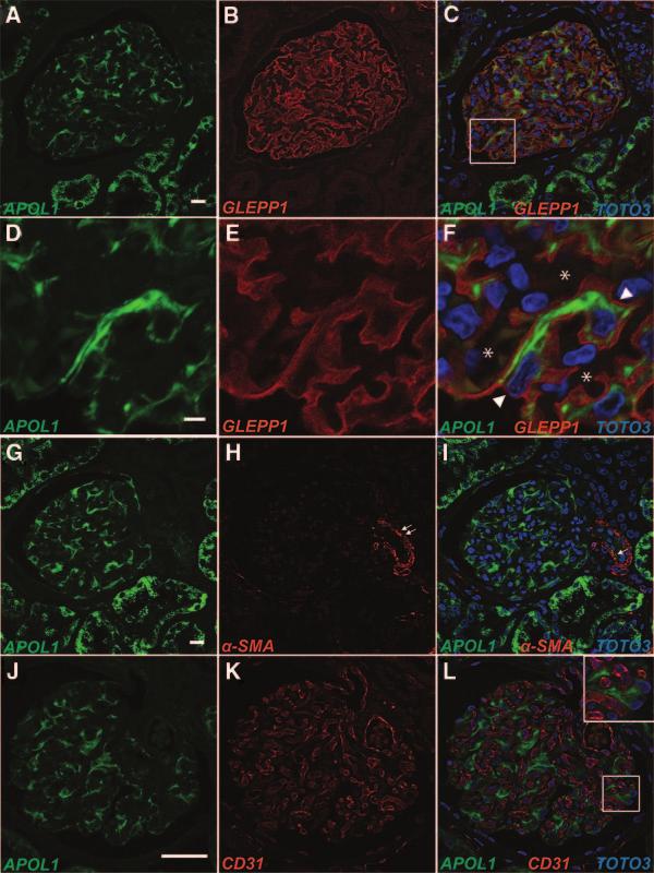 CLINICAL RESEARCH Figure 2. Colocalization of APOL1 with cell markers in the normal adult human kidney.