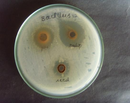 against bac BBacillus Figure 6: Antimicrobial activity of Annona muricata peel, pulp and seed against E.coli Figure 7: Antimicrobial activity of Annona muricata peel, pulp and seed against Proteus Sp.