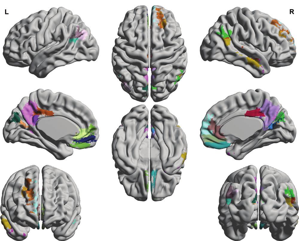 Figure 2 Figure 2: Regions of interest. The common group-level brain deactivations are parcellated by using an a priori brain atlas into different brain regions.