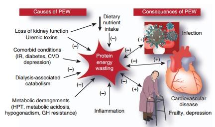 The concept of «vicious circle» of PEW in CKD/ESRD: PEW leads to complications, complications lead to PEW The ultimate