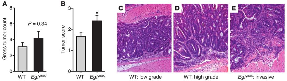 Figure 5 EGFR inhibition increases tumor progression in AOM/DSS-induced colitis.