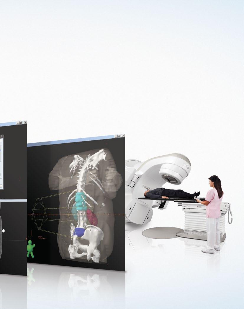 Treat a variety of cancers fast with RapidArc radiotherapy technology.