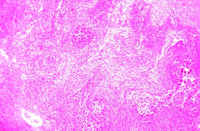 Fig 4. Histopathology of section of Spleen of a female rat showing lymphoid follicles and germinal centres (VG: 300 m/kg B.W.). normal Fig 5.