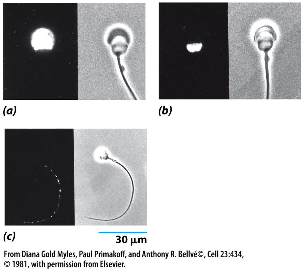 The Dynamic Nature of the Plasma Membrane 2. Highly differentiated sperm has a head, midpiece and tail that is covered by a continuous membrane.