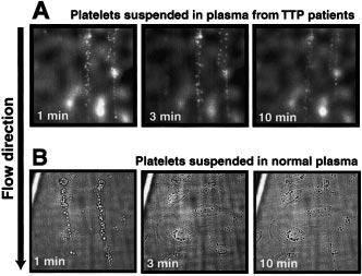 Plasma from patients with TTP did not cleave the