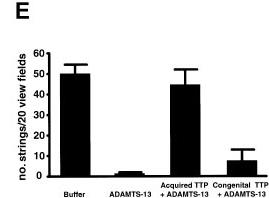 Effect of TTP plasma on the ULVWF-cleaving activity of ADAMTS-13.