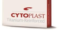 CYTOPLAST Ti-250 Anterior/Post Perio 13mm x 19mm Ti250AP-1 Ti150AP-1 $120 Ti250AP-2 Ti150AP-2 $220 Designed to fit periodontal defects in the anterior CYTOPLAST TXT-200/Singles 12mm x 24mm
