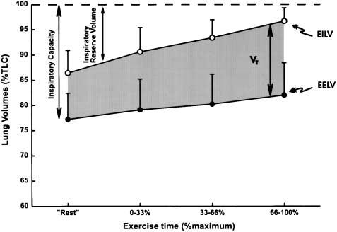 1640 AMERICAN JOURNAL OF RESPIRATORY AND CRITICAL CARE MEDICINE VOL 163 2001 Figure 2. Operational lung volumes during quiet breathing and incremental exercise.