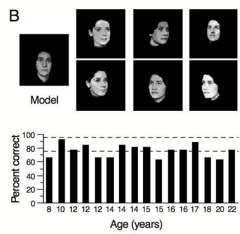 Cognitive Effects: Visual-Spatial To distinct visual tasks like face recognition, which WS patients excel at.