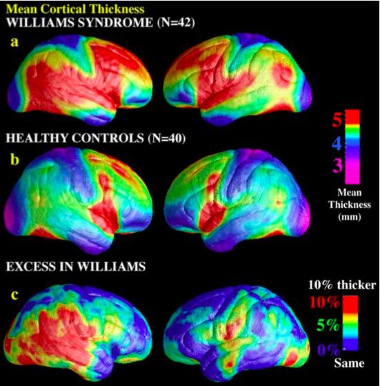 Physiological Effects: the Brain Williams