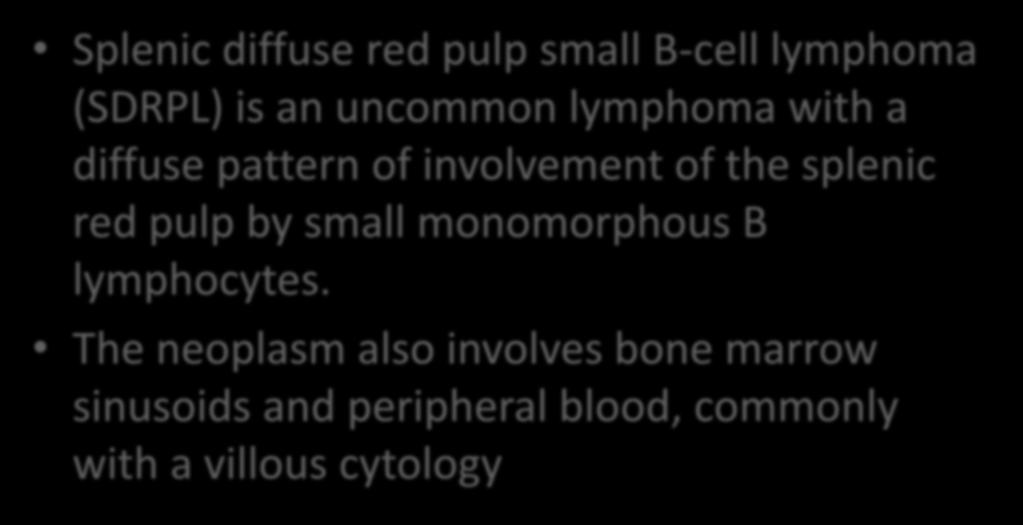 Key points from the Workshop: Splenic BCL other tan SMZL Splenic diffuse red pulp small B-cell lymphoma (SDRPL) is an uncommon lymphoma with a diffuse pattern of