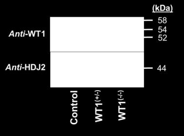 Panel B: ChIP analysis of WT1 binding to Prm1 using either input chomatin or chomatin extracted from anti-wt1, normal rabbit IgG or no 1 antibody control (-AB) immunoprecipitates.
