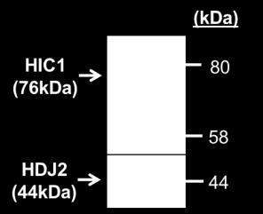 Panel B: ChIP analysis of HIC1 binding to Prm1, using either input chomatin or chomatin extracted from anti-hic1, normal rabbit IgG or no 1 antibody (-AB) immunoprecipitates.