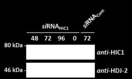 Supplemental Figure 3 (A) (B) (i) sirna WT1 (ii) sirna HIC1 (C) (D) (i) sirna WT1 (ii) sirna HIC1 Supplemental Figure 3. Effect of sirna-mediated down-regulation of WT1 and HIC1 on TP mrna expression.