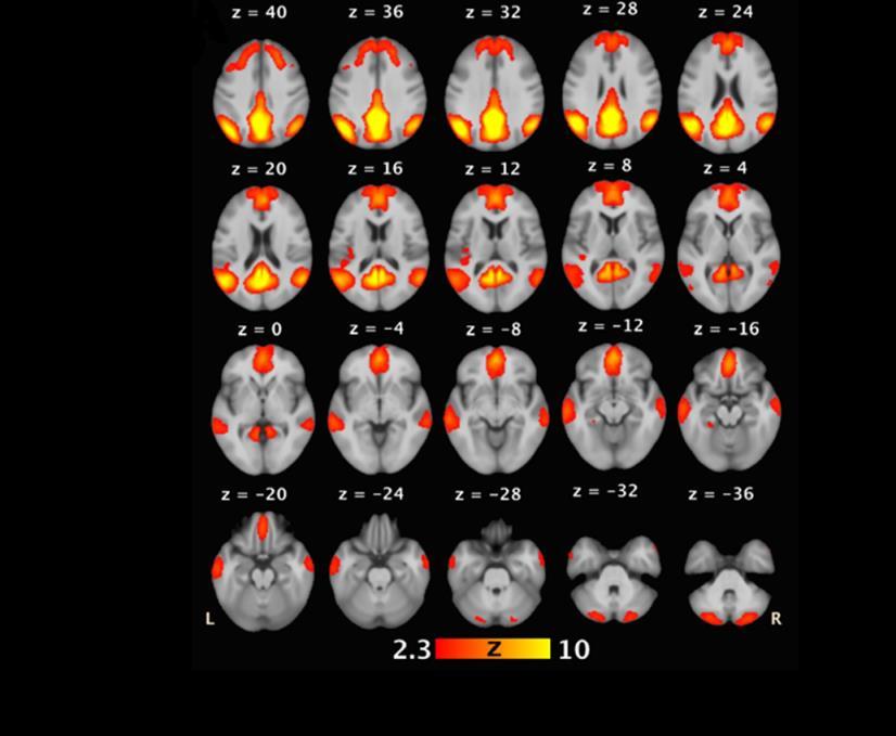 Resting state fmri connectivity is