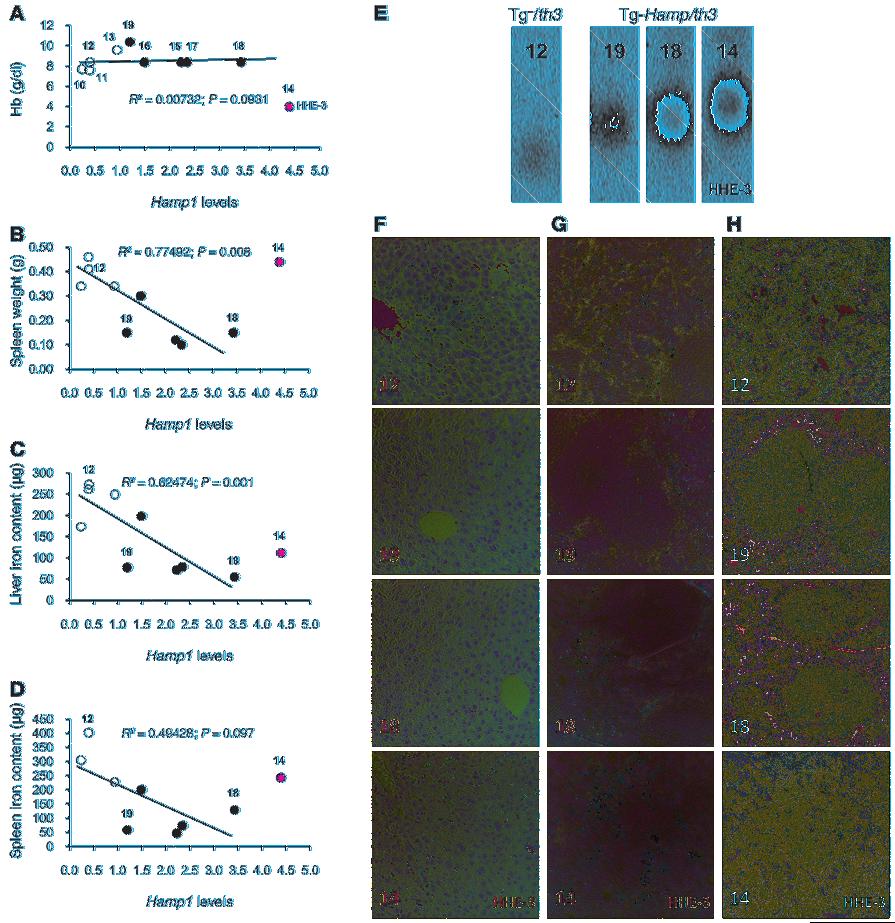 research article Figure 5 Effects of different levels of transgenic Hamp1 expression on the distribution of iron in the liver and spleen, and on spleen size and morphology in th3/+ mice.