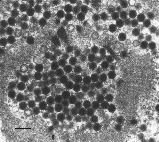 Figure 2 Transmission electron micrograph of KIRV grown in SNKD2a cells showing icosahedral particle of 100 120 nm size. Virus particles at the end of virus morphogenesis (bar = 200 nm).