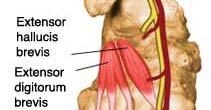 Extensor hallucis brevis: part of extensor digitorum brevis that goes to the great toe 2.