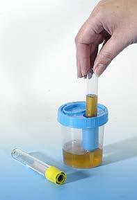 If the specimen is transferred into a Urine Tube for transport or preservation, the tube label must include the patient s full name and ID number, the date and time of collection, and the initials of