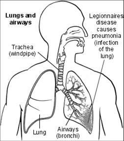 Legionnaires disease Bacteria enter lungs by