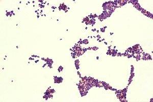 Aerococcus Urinae Risk Factors: Elderly patients with urologic conditions Identification