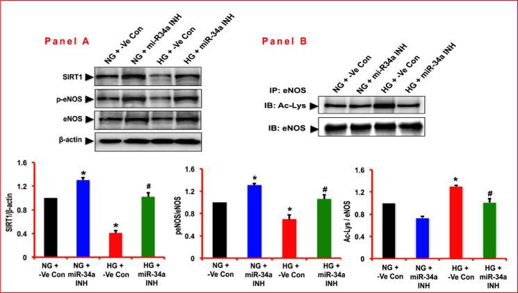 mir34a inhibitor mimics metformin Data with metformin similar for mir221 & 107 (107 decreased in HG),