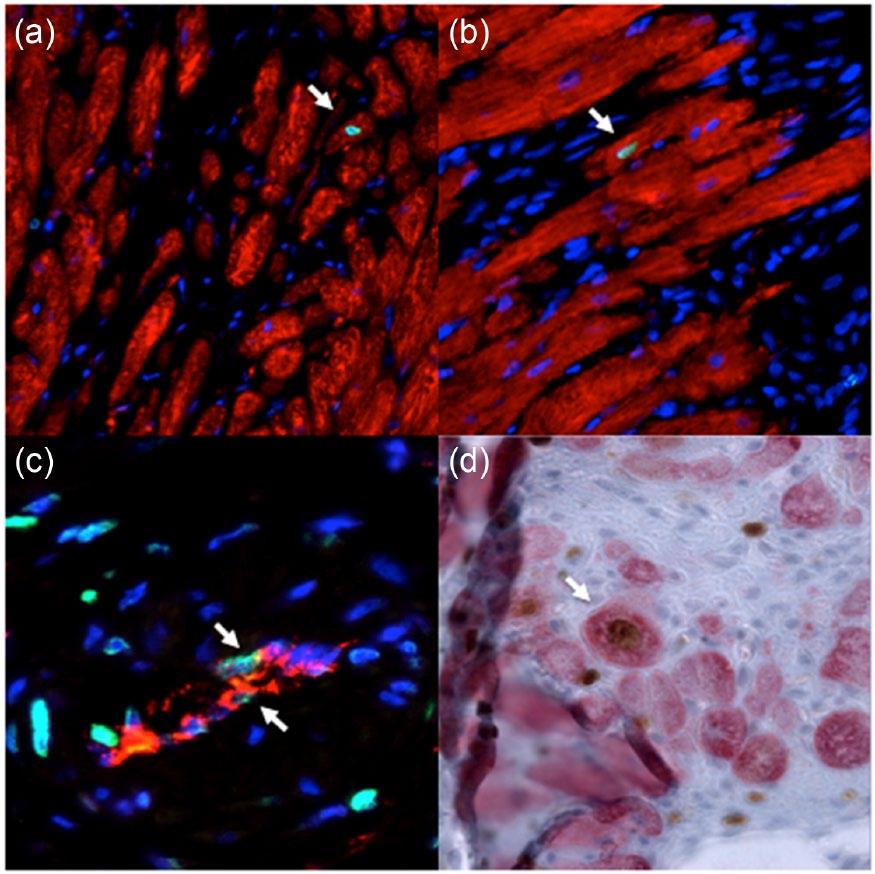 100 Journal of the Renin Angiotensin Aldosterone System 16(1) Figure 3. Cardiomyocyte regeneration and neo-vascularization after MI.
