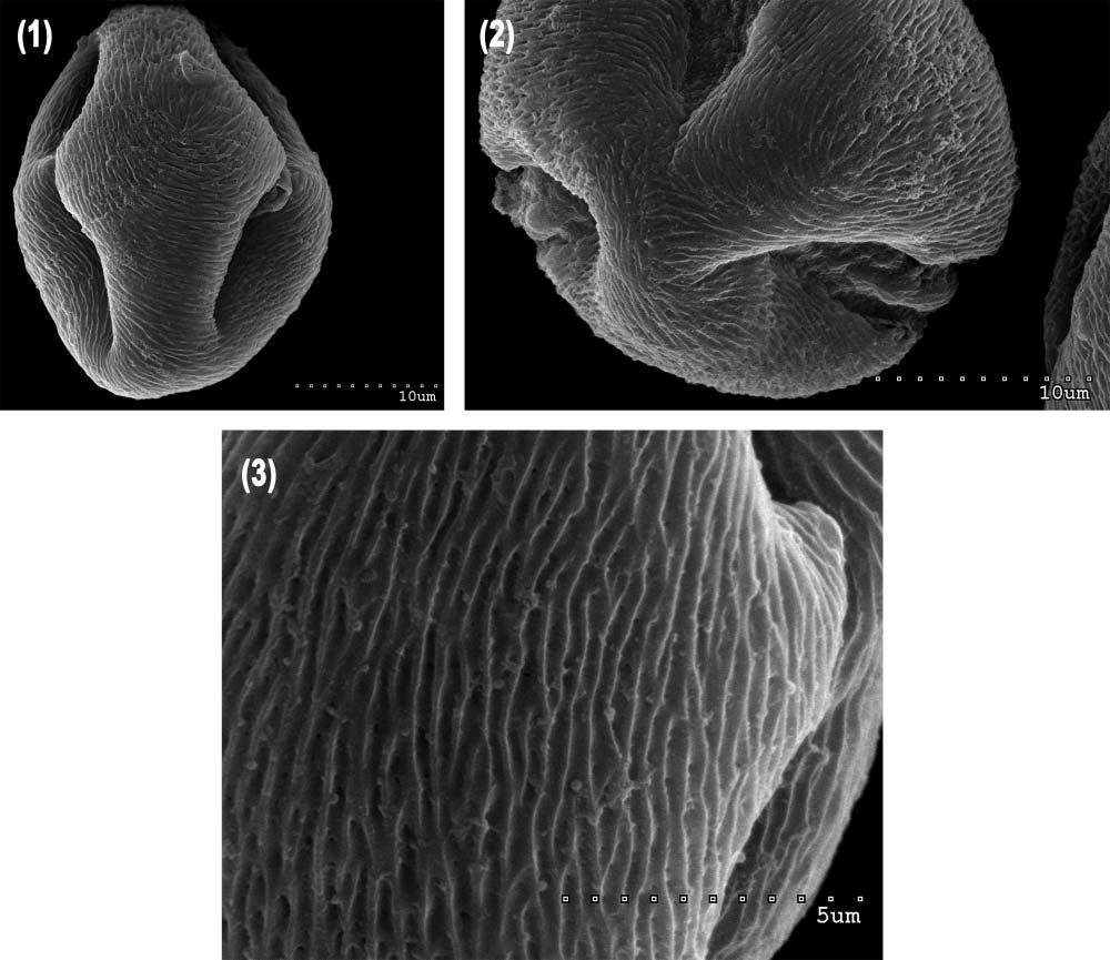 58 D. Wronska-Pilarek et al. Plate 1. 1 3 Scanning electron microphotographs of R. canina pollen grains: 1. equatorial view with two colpi end bridges; 2. polar view with tree colpi; 3.