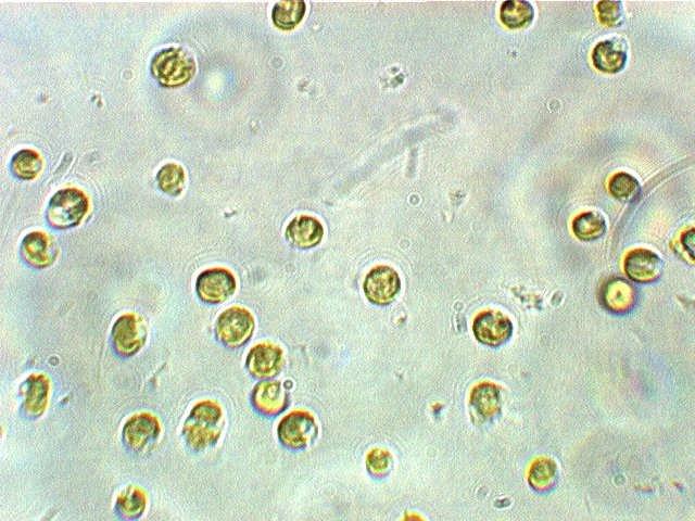 Phytoplankton (micro-algae) are microscopically small single-celled plants free floating