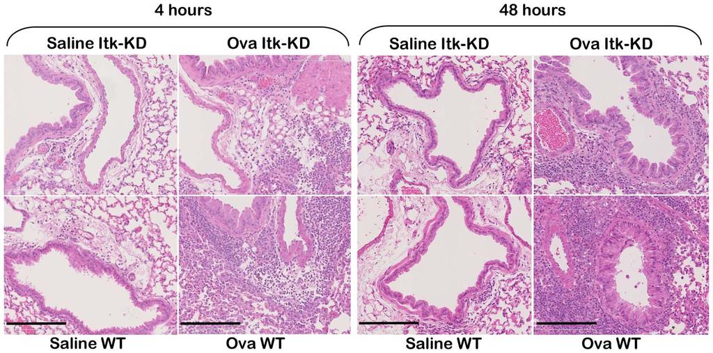 Figure 12. Histopathology of lungs from OVA model. Reduced inflammation was observed in the lung of Itk-KD compared to WT mice following sensitisation and challenge with OVA.