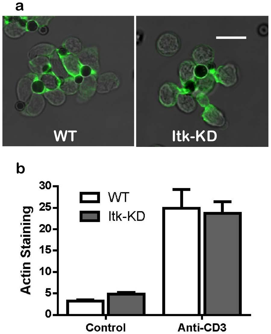 Monoclonal antibody anti-itk (clone 2F12) was used for the IP and polyclonal rabbit anti-itk for WB. doi:10.1371/journal.pone.0107490.