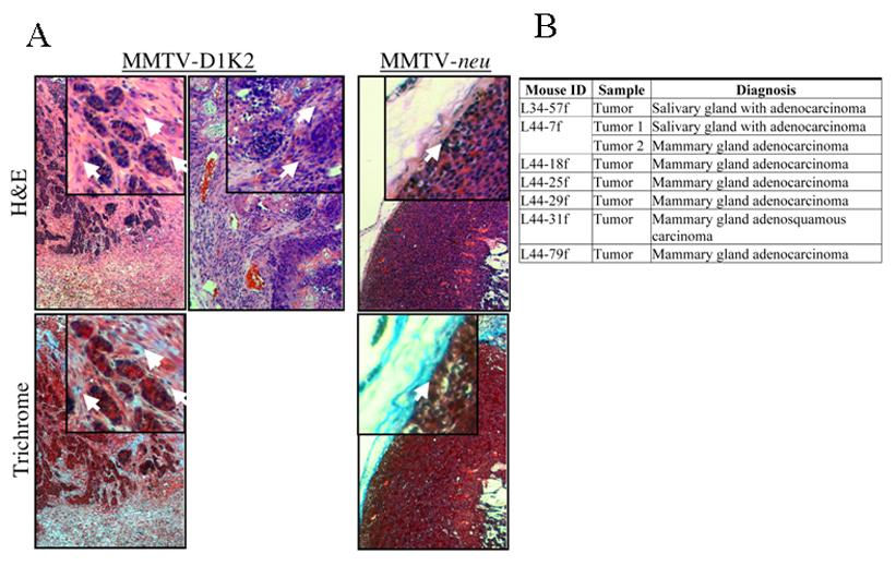 A B Figure 2-2.MMTV-D1K2 mammary and salivary tumors. A) H&E and trichrome stained histological sections of MMTV-D1K2 and MMTVneu mammary tumors.