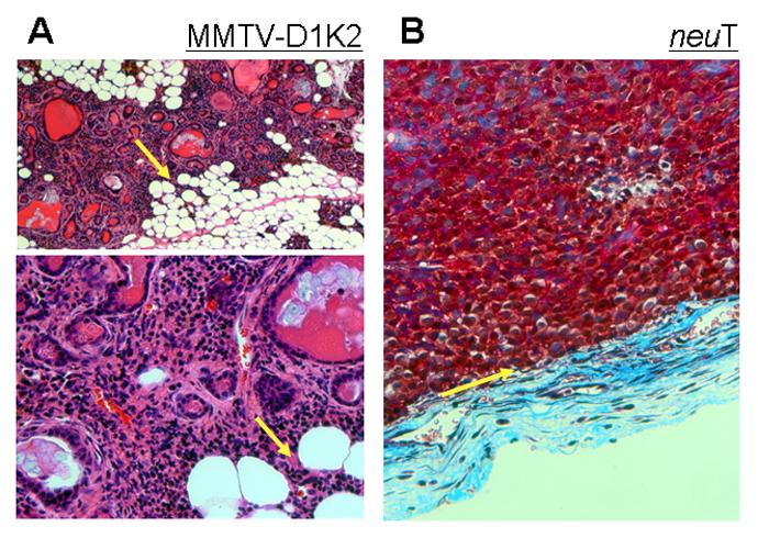 A B Figure 3-1.MMTV-D1K2 hypercellular lesions invade into the mammary stroma.
