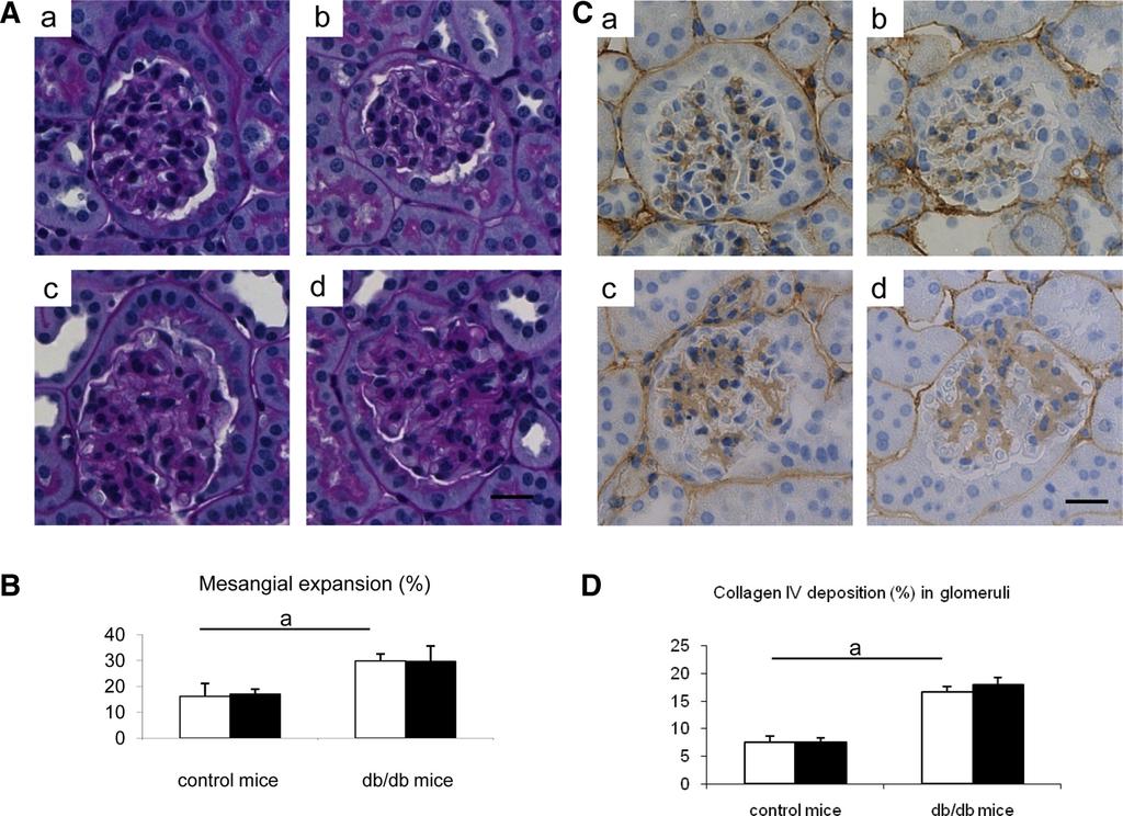 F483 Glomerular changes. PAS staining documented glomerular mesangial expansion, an early feature of diabetic nephropathy, in db/db mice compared with control C57BLKS/J mice.