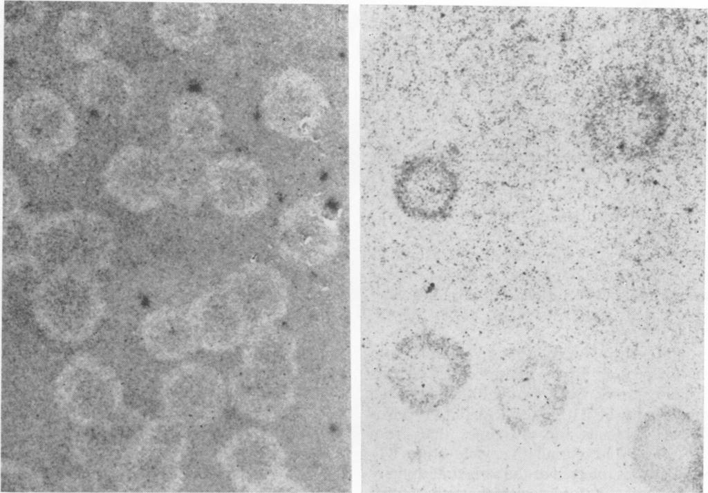 VOL. 6, 1972 * s a; s. e.5, *S 9. ftk; '*. X 2..t AWt GROWTH OF MURINE CORONAVIRUS 503 -AA / * :., *- v \ '14 AL. 4 - w x * * ^ '* b :.1 R -....._.... - 0.. -. FIG. 1. (Left) A59 virus plaques oni Py-ALIN cells at 4 days; 0.